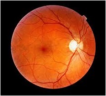 Retinal Imaging